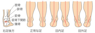 alignment2.jpg