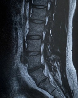 cropsebonePAS00950.jpg