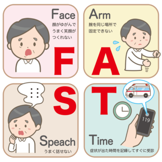 sign_cerebrovascular_disease_FAST-1-1024x1024.png