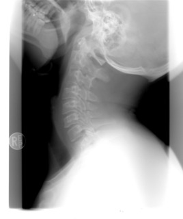 xray-1129436_1280.jpg